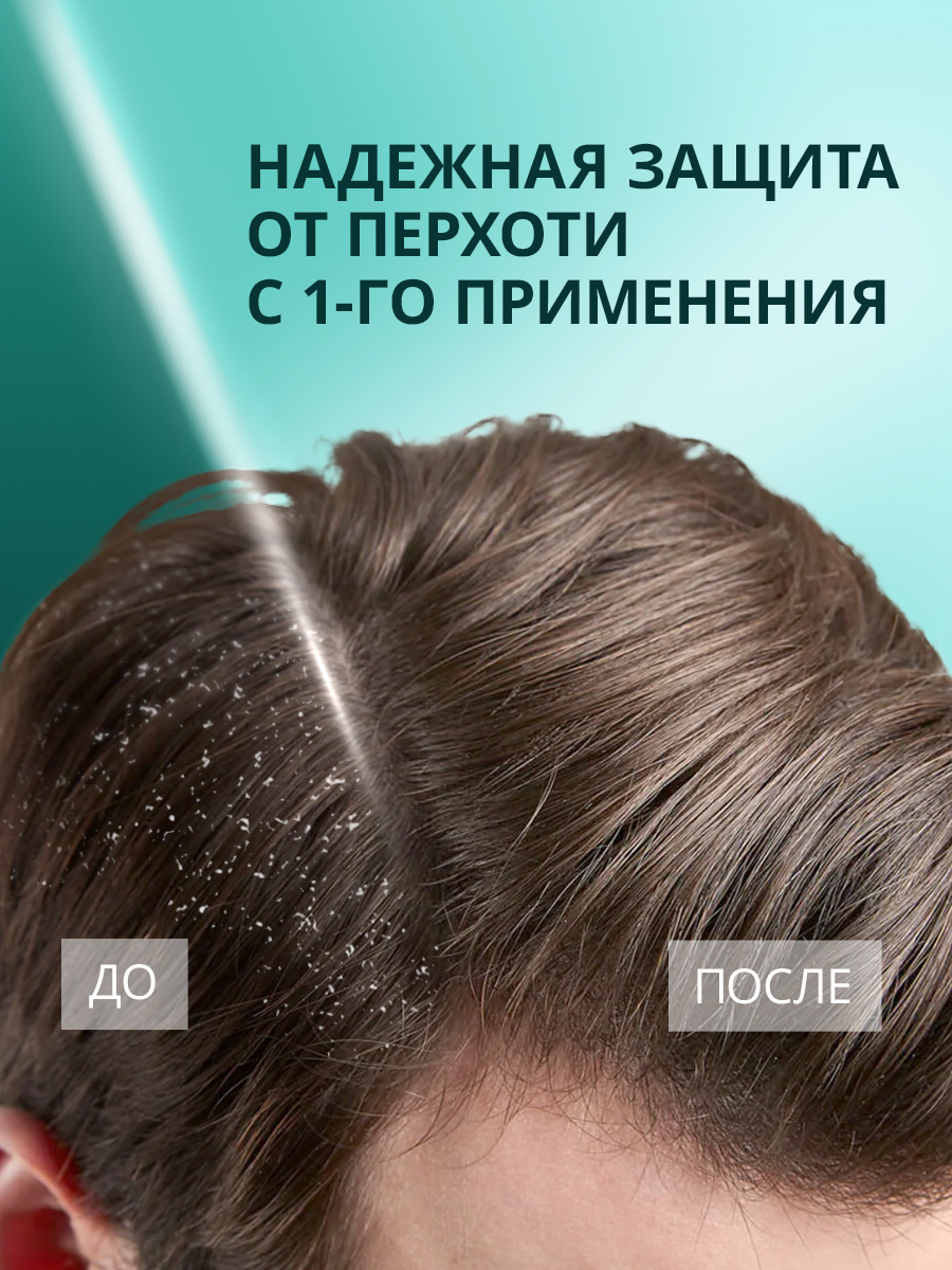 Защита от перхоти